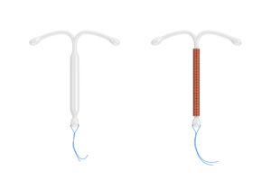 Two types of intrauterine devices (IUDs): a hormonal IUD on the left and a copper IUD on the right.