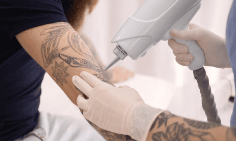 5-Secrets-You-Wished-You-Knew-Sooner-About-Tattoo-Removal-in-Singapore-1-696x465