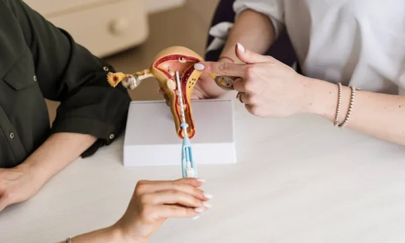 IUD Insertion Procedure