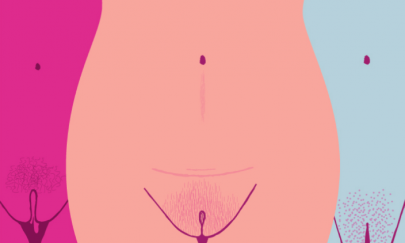 vaginal-lumps